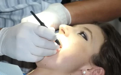 ¿Es doloroso cuando te sacan un diente? Esto dicen expertos